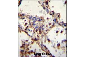 WDR52 Antibody immunohistochemistry analysis in formalin fixed and paraffin embedded human lung tissue followed by peroxidase conjugation of the secondary antibody and DAB staining. (WDR52 抗体  (C-Term))