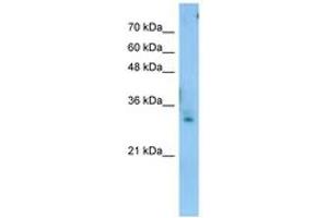 Image no. 1 for anti-Testis Expressed 264 (TEX264) (C-Term) antibody (ABIN6743447) (TEX264 抗体  (C-Term))