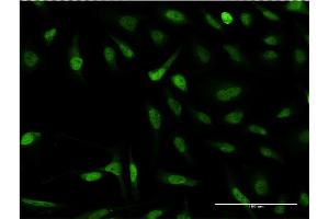 Immunofluorescence of monoclonal antibody to SNAPC4 on HeLa cell. (SNAPC4 抗体  (AA 53-162))