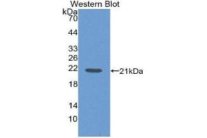 Western Blotting (WB) image for anti-Interleukin 1 delta (FIL1d) (AA 1-156) antibody (ABIN3208362) (FIL1d 抗体  (AA 1-156))