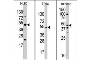 Western blot analysis of JMJD6 polyclonal antibody  in mouse heart, Hela, and HL-60 cell line lysates. (JMJD6 抗体  (N-Term))