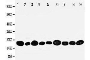 Western Blotting (WB) image for anti-Nucleoside diphosphate kinase B (NME2) (AA 137-152), (C-Term) antibody (ABIN3044198) (NME2 抗体  (C-Term))