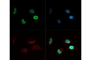 Fluorescence Microscopy (FM) image for anti-Histone H4 (acLys8) antibody (ABIN5706800)