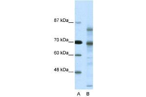 WB Suggested Anti-NCOR2  Antibody Titration: 0. (NCOR2 抗体  (N-Term))