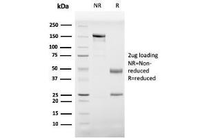 SDS-PAGE Analysis Purified Prohibitin Mouse Monoclonal Antibody (PHB/3229). (Prohibitin 抗体  (AA 167-261))