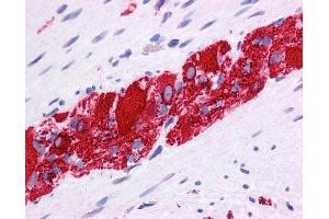 Immunohistochemistry (IHC) image for anti-Nuclear Receptor Subfamily 2, Group E, Member 1 (NR2E1) (N-Term) antibody (ABIN2779454)