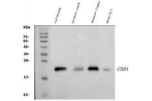 Western blot analysis of TAPA1/CD81 using anti-TAPA1/CD81 antibody (ABIN5693258).