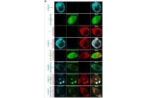 Representative images of HEK293 cells transfected with different combinations of PSD95( cat.