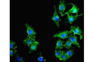 Immunofluorescence staining of A549 cells with ABIN7162378 at 1:400, counter-stained with DAPI.