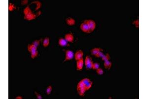 Immunofluorescent analysis of MCF-7 cells using ABIN7164407 at dilution of 1:100 and Cy3-congugated Goat Anti-Rabbit IgG (LDHD 抗体  (AA 310-507))