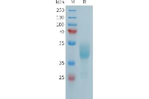 SDS-PAGE (SDS) image for Fc Receptor-Like 5 (FCRL5) (AA 752-834) protein (Fc Tag) (ABIN7538227)
