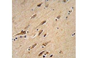 ARF1 antibody immunohistochemistry analysis in formalin fixed and paraffin embedded human brain tissue. (ARF1 抗体  (AA 80-106))