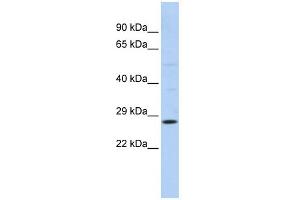 WB Suggested Anti-RAB38 Antibody Titration:  0. (RAB38 抗体  (N-Term))