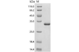 (Tris-Glycine gel) Discontinuous SDS-PAGE (reduced) with 5 % enrichment gel and 15 % separation gel.