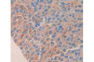 Used in DAB staining on fromalin fixed paraffin- embedded Kidney tissue (STAT1 抗体  (AA 432-680))