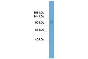 WB Suggested Anti-Lbxcor1 Antibody Titration:  0.