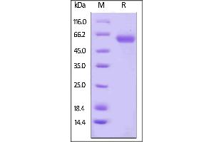 SDS-PAGE (SDS) image for CD48 (CD48) (AA 27-220) (Active) protein (Fc Tag) (ABIN6253683)