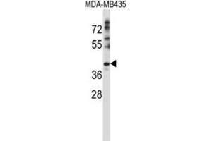 Western Blotting (WB) image for anti-DnaJ (Hsp40) Homolog, Subfamily C, Member 28 (DNAJC28) antibody (ABIN2997421) (DNAJC28 抗体)