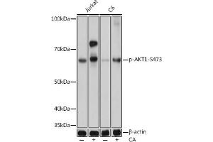 Western blot analysis of extracts of various cell lines, using Phospho--S473 mAb (ABIN6135179, ABIN6135970, ABIN6135971 and ABIN7101880) at 1:1000 dilution. (AKT1 抗体  (pSer473))