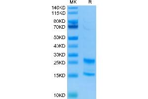 Human IL-17A&F on Tris-Bis PAGE under reduced conditions. (IL-17A/F Protein (AA 24-155) (His tag))