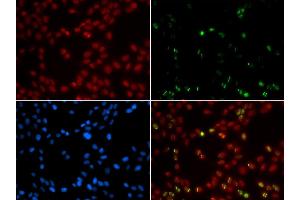 Immunofluorescence analysis of GFP-RNF168 trangenic U2OS cell using SUMO1 antibody. (SUMO1 抗体  (AA 1-101))