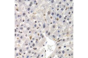 Immunohistochemistry of paraffin-embedded rat liver using GTF2F1 antibody (ABIN5971324) at dilution of 1/200 (40x lens).
