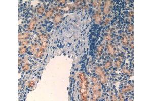 Used in DAB staining on fromalin fixed paraffin- embedded kidney tissue (MT2 抗体  (AA 1-61))