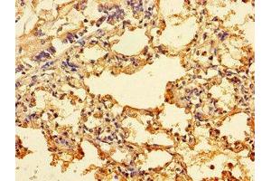 Immunohistochemistry of paraffin-embedded human lung tissue using ABIN7156249 at dilution of 1:100 (ING3 抗体  (AA 51-223))