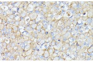 Immunohistochemistry of paraffin-embedded Rat ovary using MADCAM1 Polyclonal Antibody at dilution of 1:100 (40x lens). (MADCAM1 抗体)