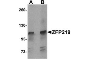 Western blot analysis of ZFP219 in mouse brain tissue lysate with ZFP219 antibody at (A) 1 and (B) 2 μg/ml. (ZNF219 抗体  (N-Term))