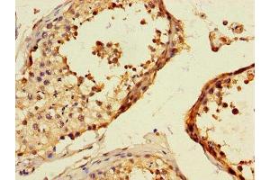 Immunohistochemistry of paraffin-embedded human testis tissue using ABIN7172291 at dilution of 1:100 (TLL1 抗体  (AA 522-643))