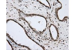 Immunohistochemical staining of paraffin-embedded Kidney tissue using anti-APP mouse monoclonal antibody. (APP 抗体)