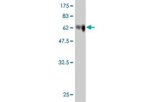 Western Blot detection against Immunogen (74. (SOCS4 抗体  (AA 1-440))