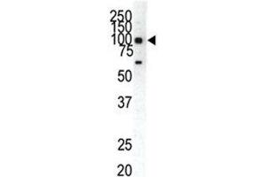 Western blot analysis of EphA1 antibody and HeLa cell lysate. (EPHA1 抗体  (AA 913-943))