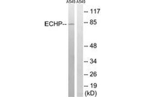 Western blot analysis of extracts from A549 cells, using EHHADH Antibody. (EHHADH 抗体  (AA 476-525))