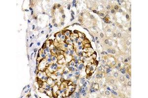 Immunohistochemistry of paraffin-embedded Rat kidney using LIPG Polyclonal Antibody at dilution of 1:200 (40x lens). (LIPG 抗体)