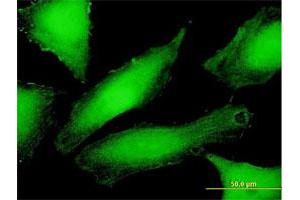 Immunofluorescence of purified MaxPab antibody to PSMD10 on HeLa cell. (PSMD10 抗体  (AA 1-226))