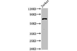 Western Blot Positive WB detected in: Jurkat whole cell lysate All lanes: Pcsk1 antibody at 3 μg/mL Secondary Goat polyclonal to rabbit IgG at 1/50000 dilution Predicted band size: 71 kDa Observed band size: 71 kDa (PCSK2 抗体  (AA 109-637))
