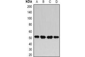 Western blot analysis of HAPLN1 expression in BT474 (A), MCF7 (B), Hela (C), HepG2 (D) whole cell lysates. (HAPLN1 抗体)