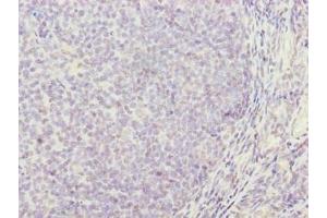Immunohistochemistry of paraffin-embedded human tonsil tissue using ABIN7171361 at dilution of 1:100 (TRIM 抗体  (AA 29-186))