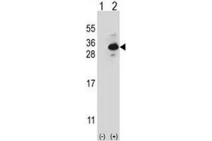 Western blot analysis of CLTB (arrow) using rabbit polyclonal CLTB Antibody . (CLTB 抗体  (Light Chain))