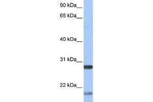 WB Suggested Anti-BDNF Antibody Titration:  0. (BDNF 抗体  (Middle Region))