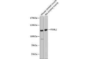Western blot analysis of extracts of various cell lines, using PIWIL2 antibody (ABIN6132495, ABIN6145700, ABIN6145701 and ABIN6221680) at 1:1000 dilution. (PIWIL2 抗体)