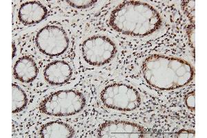 Immunostaining (ISt) image for anti-Sp1 Transcription Factor (SP1) (AA 89-198) antibody (ABIN520394)