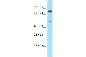 Host: Rabbit Target Name: PTCD1 Sample Type: Jurkat Whole Cell lysates Antibody Dilution: 1. (PTCD1 抗体  (N-Term))