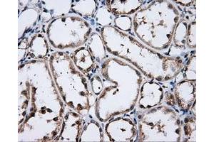 Immunohistochemical staining of paraffin-embedded Kidney tissue using anti-LIPG mouse monoclonal antibody. (LIPG 抗体)