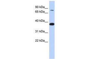 Image no. 1 for anti-Zinc Finger Protein 526 (ZNF526) (AA 179-228) antibody (ABIN6740285) (ZNF526 抗体  (AA 179-228))