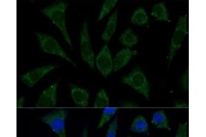 Immunofluorescence analysis of L929 cells using AKR1C2 Polyclonal Antibody at dilution of 1:100 (40x lens). (AKR1C2 抗体)