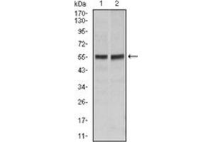 Western Blotting (WB) image for anti-TNF Receptor Superfamily, Member 6 (FAS) antibody (ABIN1106616) (FAS 抗体)
