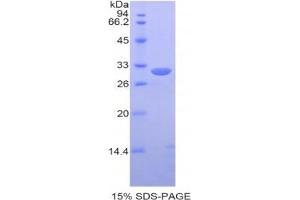 SDS-PAGE analysis of Human PDIA3 Protein.